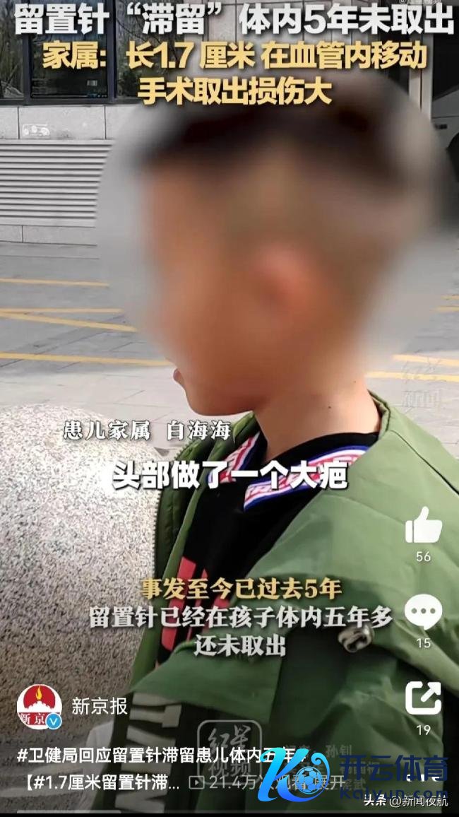 1.7厘米留置针淹留男童体内5年 重新皮跑到腮腺